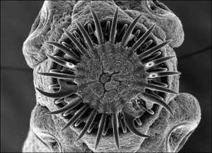 The pork tapeworm; image courtesy of Dennis Kunkel Microscopy, Inc.